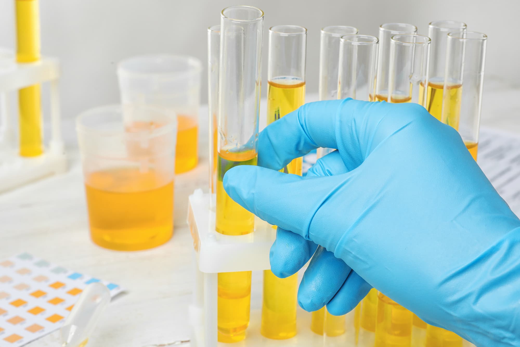 Urine